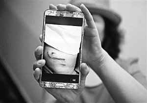 家长花6万送孩子学艺 百余学生被曝遭老师钢棍打