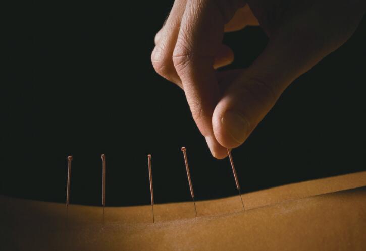 维基百科英文网站将针灸定义为&ldquo;伪科学&rdquo; 网友炮轰