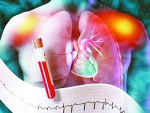 猝死前，心脏会发求救信号