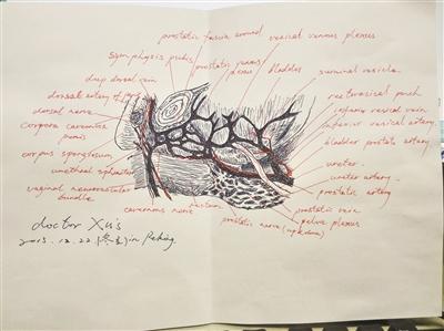 医生手绘图向病人解释病情：让患者更加理解医生