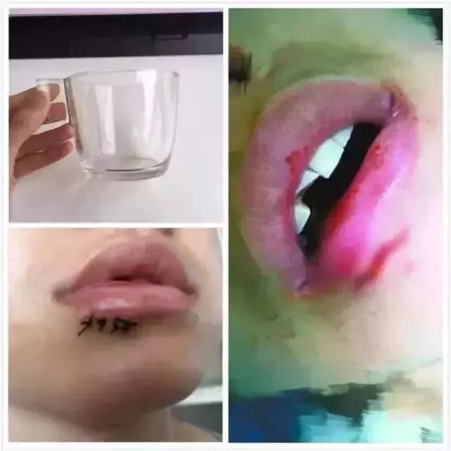 宜家水杯爆炸案二审维持原判：伤者获赔4万余元!