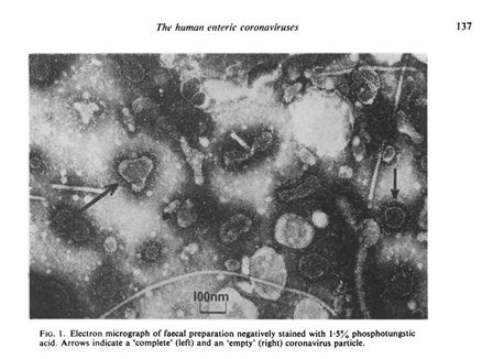 为什么会&ldquo;复阳&rdquo;？&ldquo;复阳&rdquo;有无传染性？专家这样解释