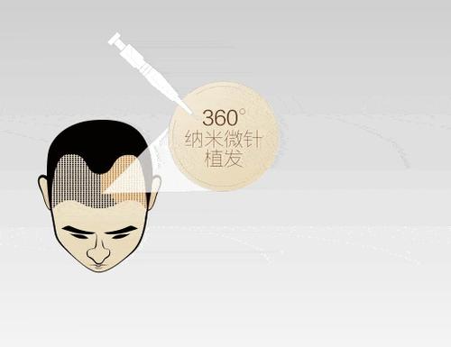 “秃”然崛起的“脱发经济”，背后乱象需警惕