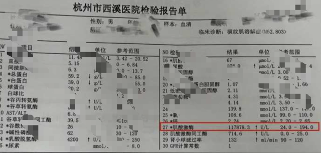 骑了40分钟动感单车,接着深蹲、卧推!杭州小伙整晚疼得睡不着,一查又是这个病 国家品牌网