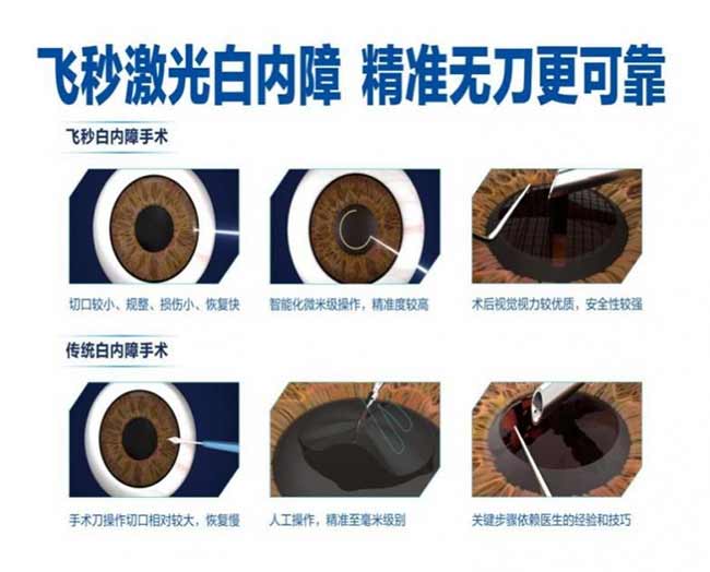 突破年龄壁垒！汉中爱尔眼科飞秒白内障新技术，助力 27 岁患者摆脱眼疾困扰